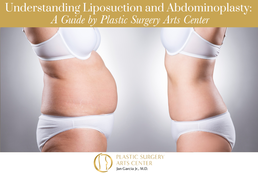 Understanding Liposuction and Abdominoplasty A Guide by Plastic Surgery Arts Center